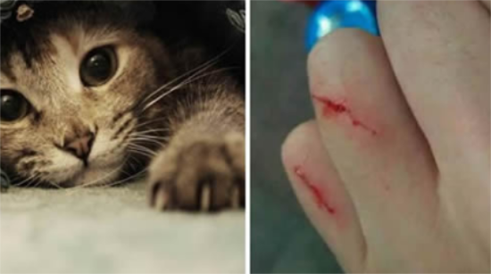 被猫抓伤，要打狂犬病疫苗吗？